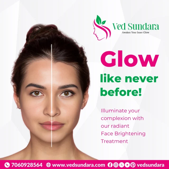 ✨ Reveal Your Radiant Glow! ✨
Tired of dull skin stealing your shine? Experience the transformation with our Face Brightening Treatment and glow like never before! 💆‍♀️💫
Because your skin deserves the spotlight. 🌟

📞 Book now: 7060928564
🌐 Visit: www.vedsundara.com

#VedSundara #AwakenYourInnerGlow #FaceBrightening #SkinGlowUp #FlawlessSkin #BeautyCare #RadiantSkin #SkinTransformation #SkinClinicIndia #GlowLikeNeverBefore #NaturalGlow #SkinGoals #SkincareJourney #FacialTreatment #HealthySkinStartsHere