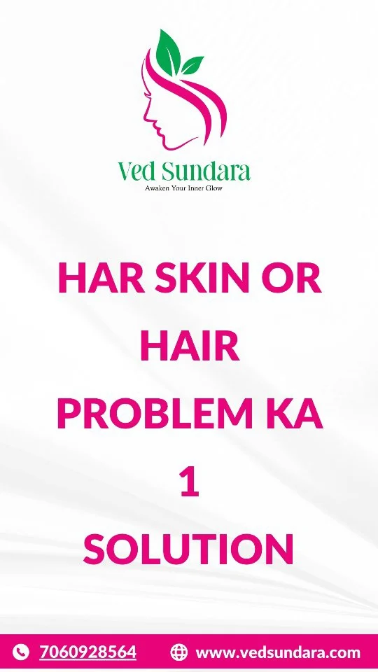 Unlock Radiance, Naturally! 
Discover the power of Ayurveda with Ved Sundara.
Say goodbye to pigmentation, acne, and dullness — and hello to glowing, healthy skin 🌿💫

📍Visit us today and feel the difference.
🌐 www.vedsundara.com
📞 +91-7060928564

#VedSundara #AyurvedicSkincare #GlowingSkinNaturally #SkinCareRoutine #PigmentationTreatment #AyurvedaForSkin #ClearSkinJourney #NaturalBeauty #HerbalGlow #SkinTransformation #HealthySkinSecrets