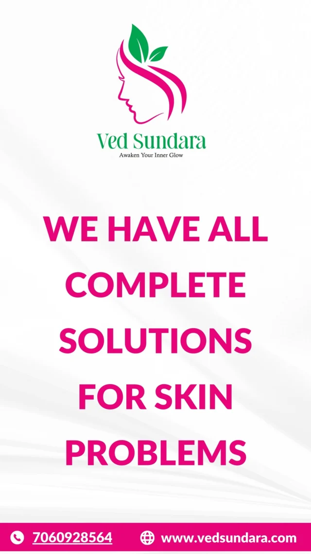 No more confusion, no more compromise—Glowing skin. Healthy hair...
One name—Ved Sundara. Your all-in-one Ayurvedic solution.
Ved Sundara is your trusted solution for skin and hair problems
✔ Ayurvedic ingredients with proven benefits
✔ Customized skin & hair care solutions
✔ Free consultation & expert guidance
✔ Visible results without harsh chemicals
✔ Trusted by thousands of satisfied users

📲 Book your consultation: 7060928564
🔗 Explore more: www.vedsundara.com

#VedSundara #AyurvedicCare #GlowingSkinNaturally #HairFallSolution #SkinCareRoutine #NaturalBeauty #AyurvedicProducts #PigmentationTreatment #AyurvedaForLife #HealthyHairJourney #SkincareThatWorks #HairCareGoals #HerbalRemedies #NoMoreHairFall #ClearSkinNaturally #VedSundaraResults #DesiNuskhe #SkincareIndia #AyurvedaLovers #WellnessWithAyurveda